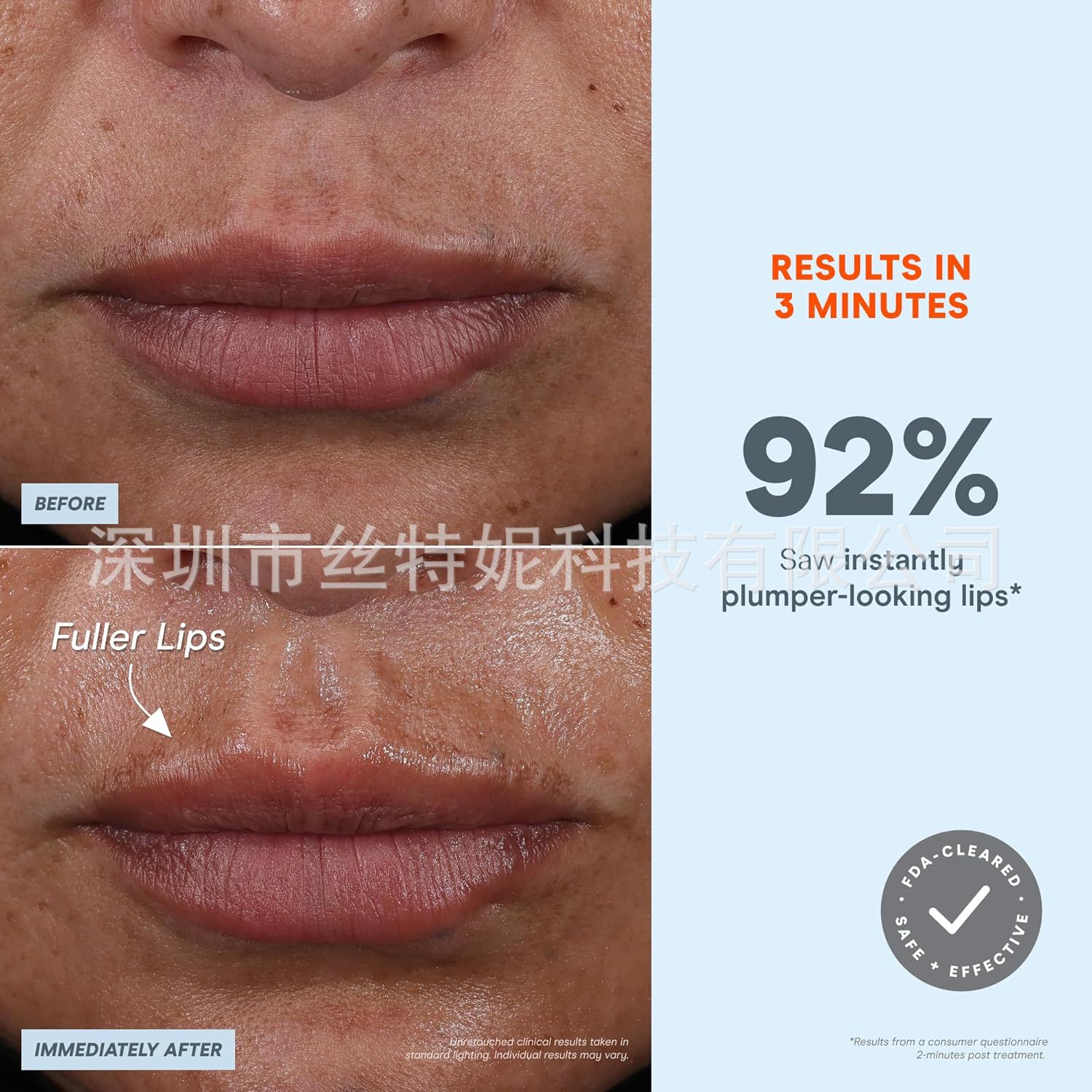 Microcurrent Facial Beauty Device