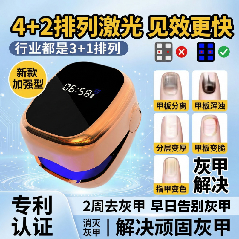 External Onychomycosis UV Fungus Lamp Explosive Liquid Auxiliary Light Therapy Clean Portable Nail Lamp Ultraviolet