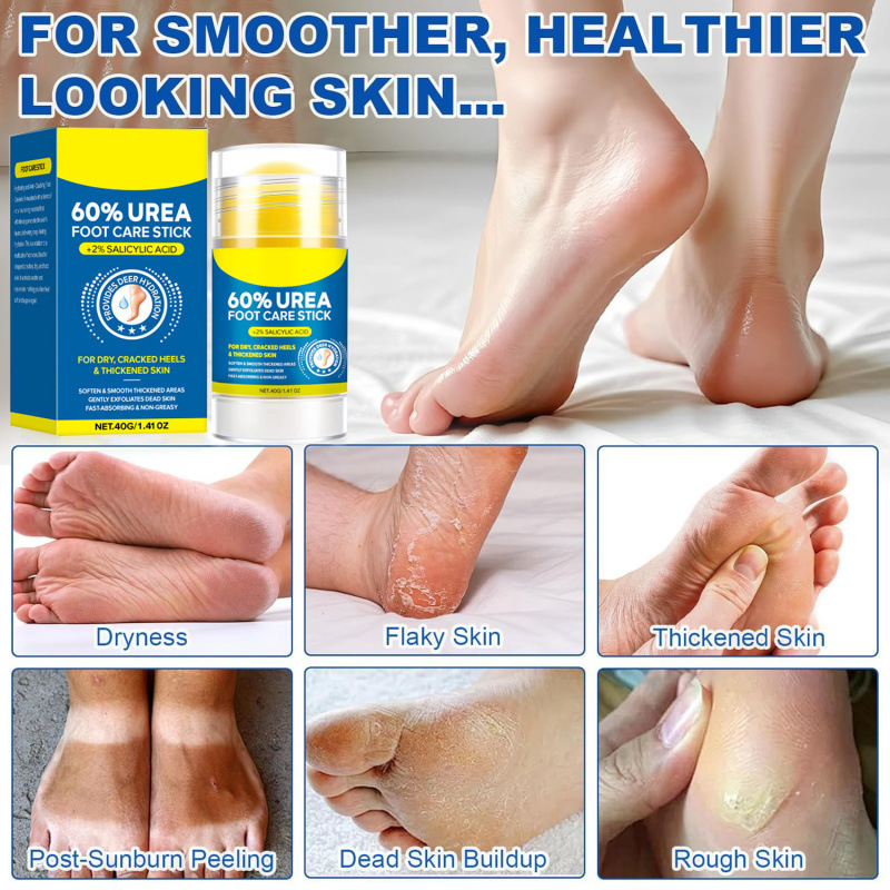 TK Salicylic Acid Urea Hand Foot Care Stick Autumn Winter Anti-Crack Moisturizing Hydrating Peach Lanolin