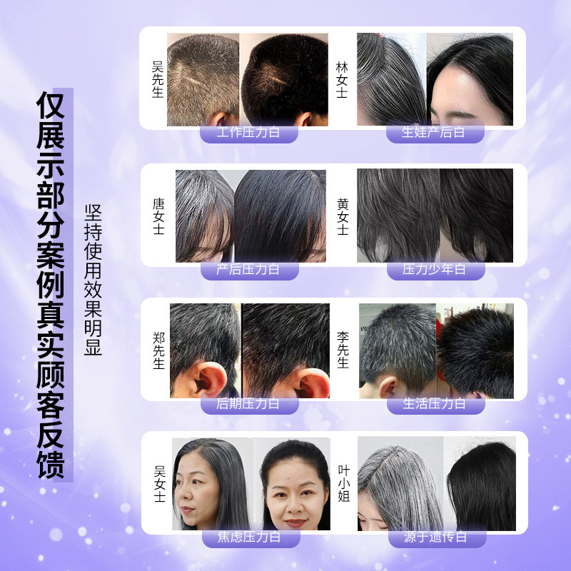Black Technology Hair Nourishing Comb Improves White Hair Massage Comb Nourishing Black Red Blue Light Hair Growth Instrument Hair Care Laser Comb