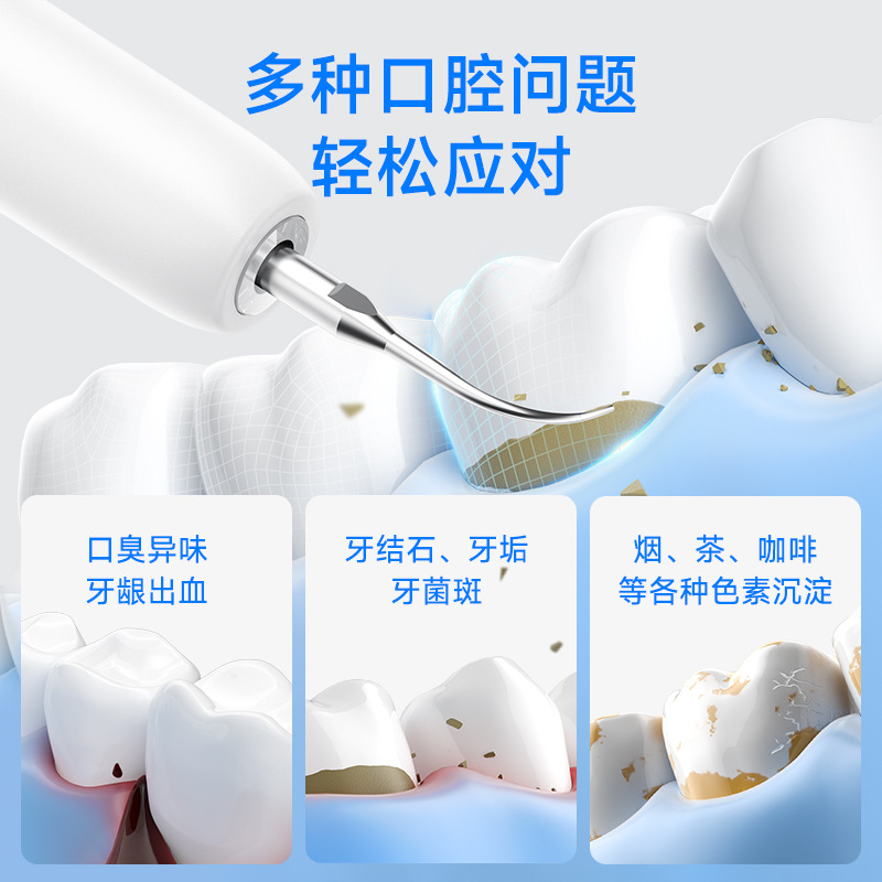 Yue'er Wanwan ultrasonic tooth cleaner, home smart ultrasonic tooth cleaner, plaque remover, personal care teeth whitening device