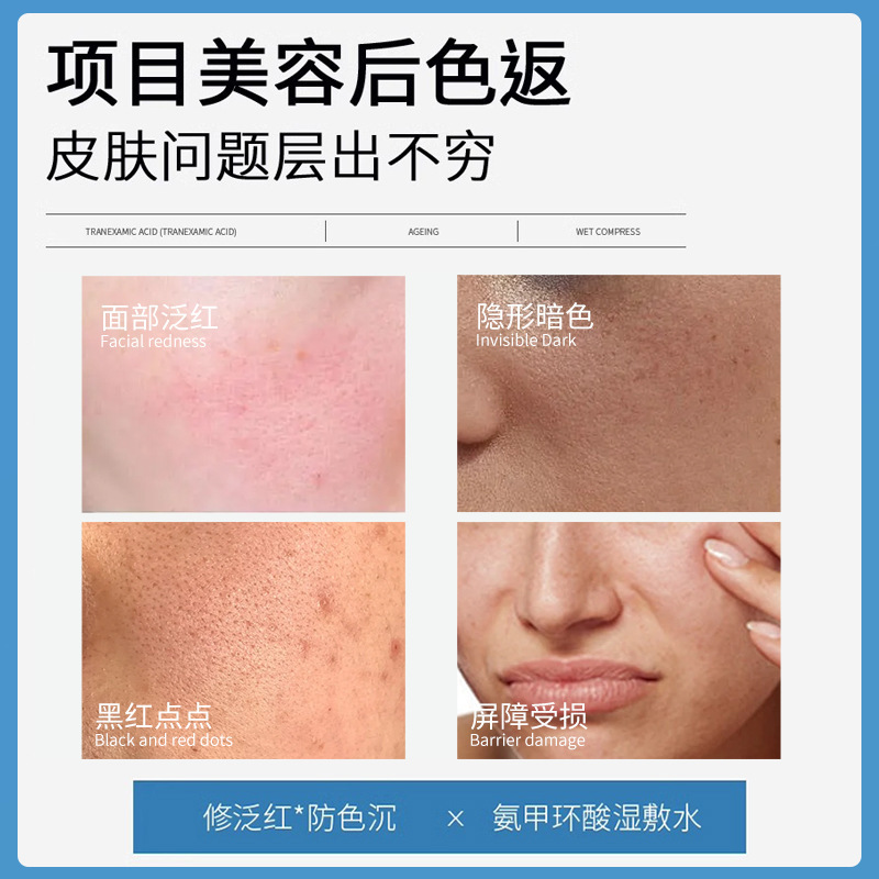 5% Tranexamic Acid Niacinamide Wet Compress Liquid - Essence, External Use, Brightening, Anti-Darkening