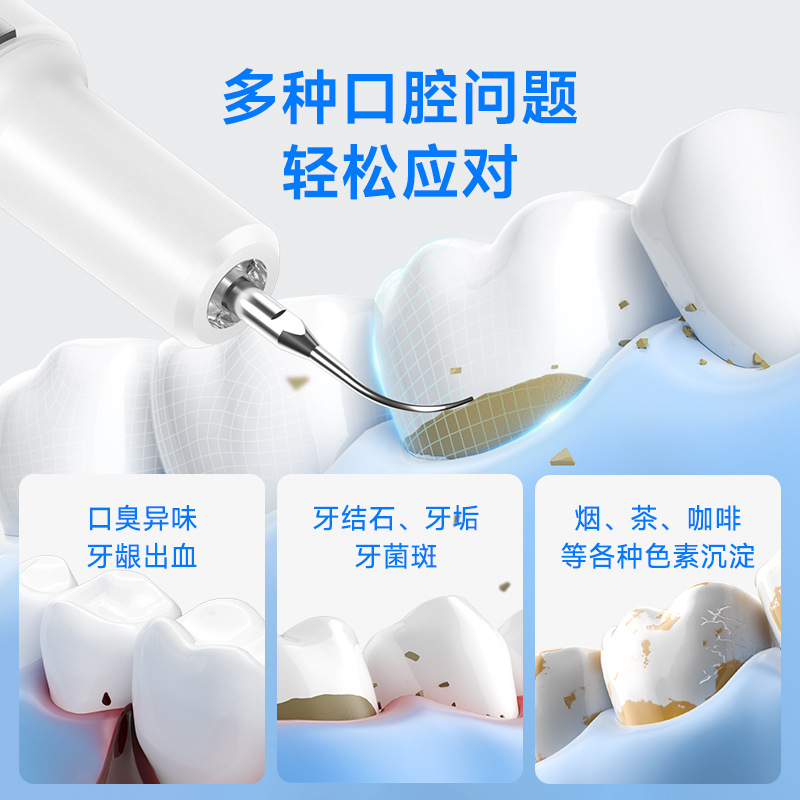 Yue'er Wanwan ultrasonic tooth cleaner, electric tooth cleaner, removes tartar, oral cleaning