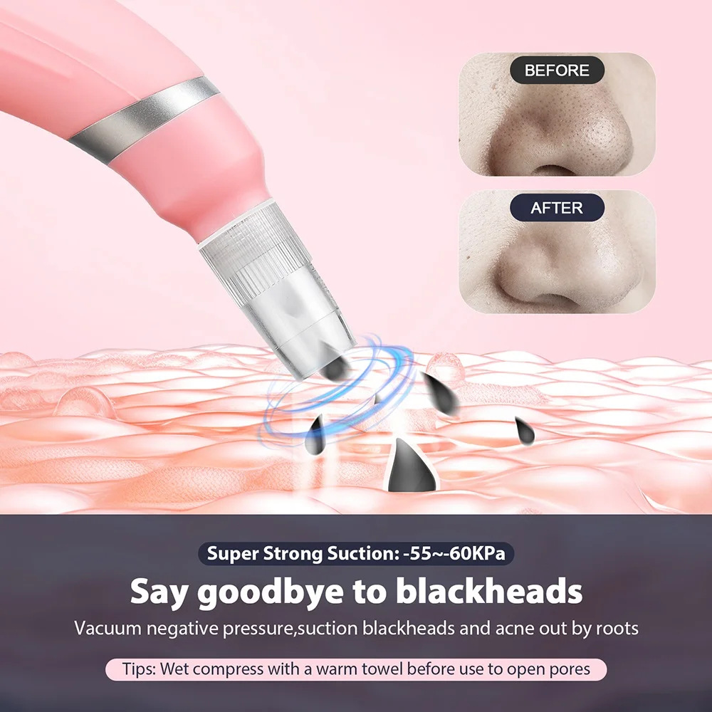 Exclusive Diamond Microdermabrasion Head Microcrystal Skin Renewal Blackhead Removal Dead Skin Removal Handheld Microdermabrasion Machine Blackhead Suction