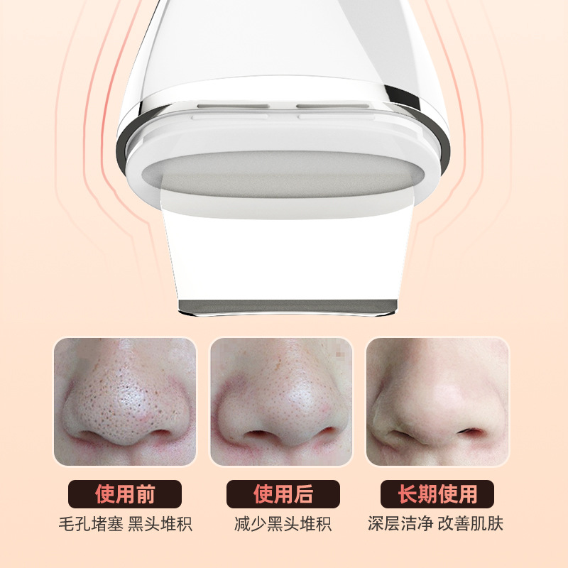 New Electric Skin Scraper Instrument Micro Skin Scraper Remove Blackhead Acne Color Light Ultrasonic Dead Skin Import Export Beauty Instrument