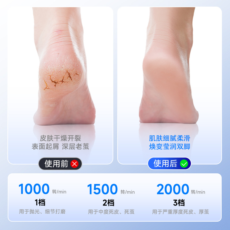 Automatic callus remover, dedicated dead skin remover, foot file, heel grinder, home electric