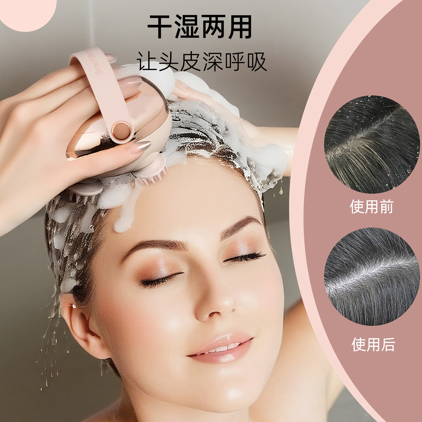 Special Head Massager Stress Relief Acupoint Scalp Meridian Red Light Massager Portable Pet Massager