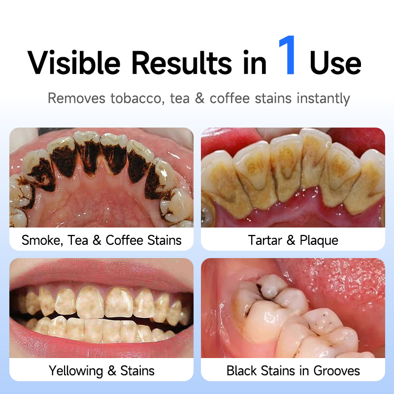 New waterproof electric teeth whitening device, tooth polisher, plaque and yellow teeth remover, oral stain cleaner