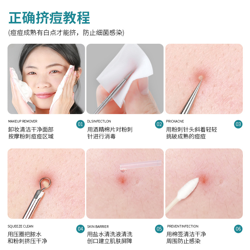 GECOMO stainless steel acne needle set blackhead needle pimple clip tweezers beauty tool cell clip beauty needle