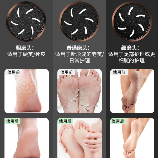 Anti-Dust Electric Foot File Type-C Charging Waterproof Callus Dead Skin Remover Pedicure Tool New Foot Care Custom
