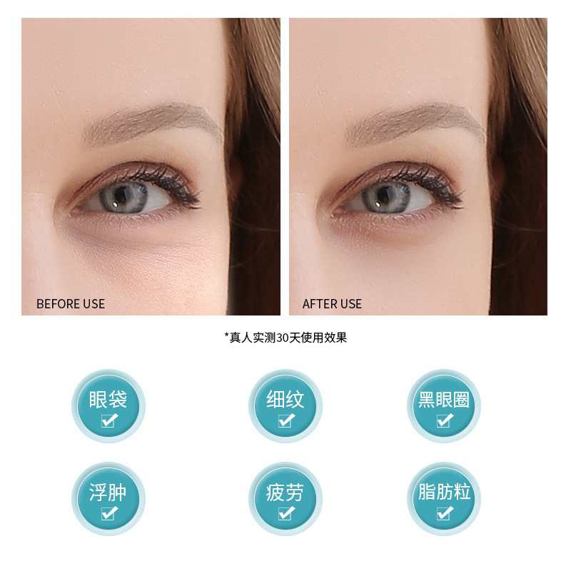 Eye Lifting Bar Eye Beauty Instrument Beauty Instrument Home Import Eye Small Iron Tightening Massage Instrument Massager