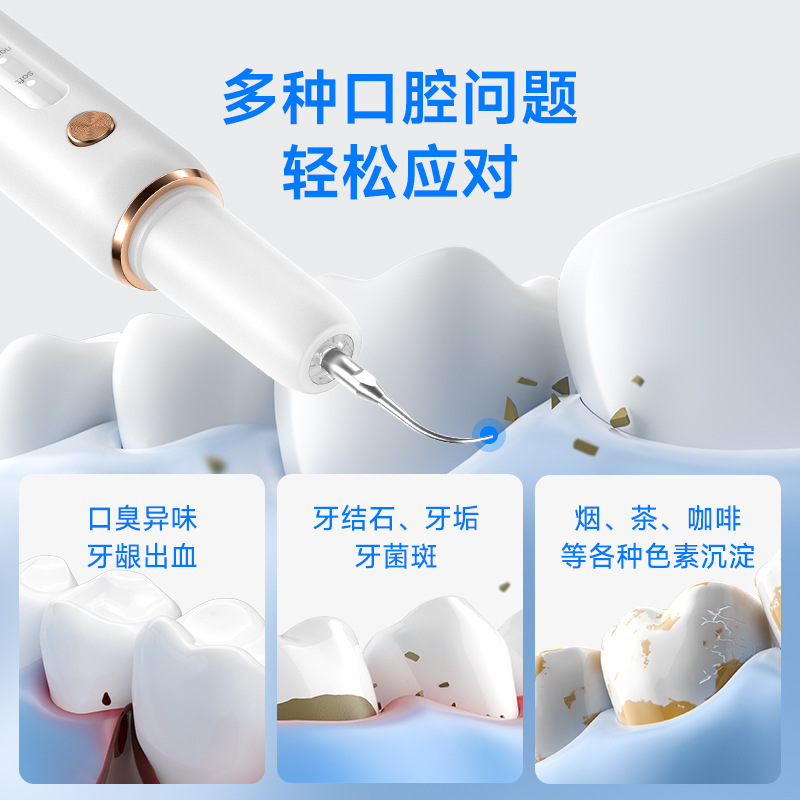 Yue'er Wanwan ultrasonic tooth cleaner, removes tartar and tooth stains, cleaning machine, plaque remover