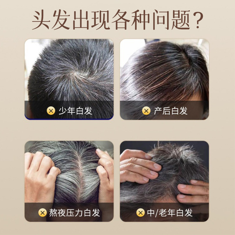 Bath King Series He Shou Wu Plant Extract Shampoo - Anti-Dandruff, Oil Control, Anti-Itch, Volumizing, Nourishing