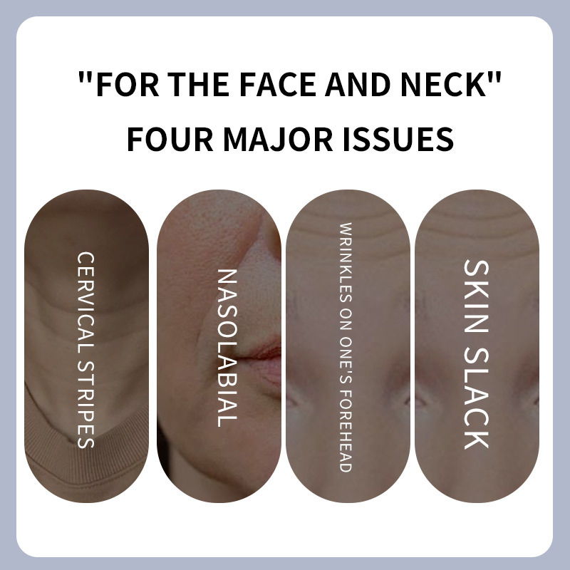 Neck Massager Remove Neck Lines Import Instrument Face Lifting EMS Microcurrent Neck Beauty Instrument Anti-Aging Anti-Wrinkle